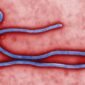 Petugas kesehatan menangani pasien yang menjalani isolasi terkait kasus Ebola di Nigeria.