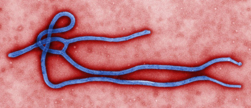 Virus Ebola.